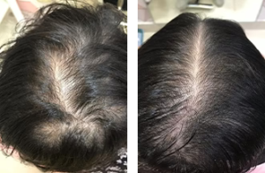 PH-Before-and-After-1