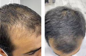 PH-Before-and-After-4